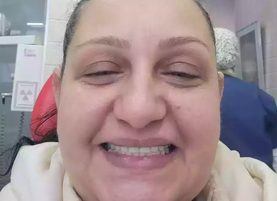 Después